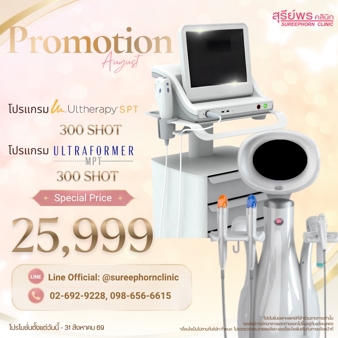 🚀 Promtion August ⭐️🚀